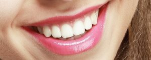 Best Teeth Whitening